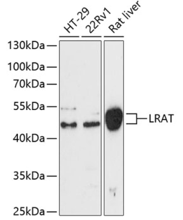 LRAT Rabbit Polyclonal Antibody