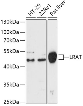 LRAT Rabbit Polyclonal Antibody