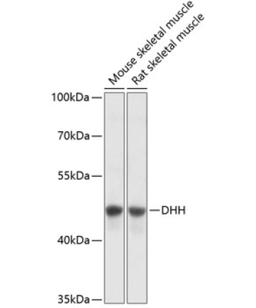 DHH Rabbit Polyclonal Antibody