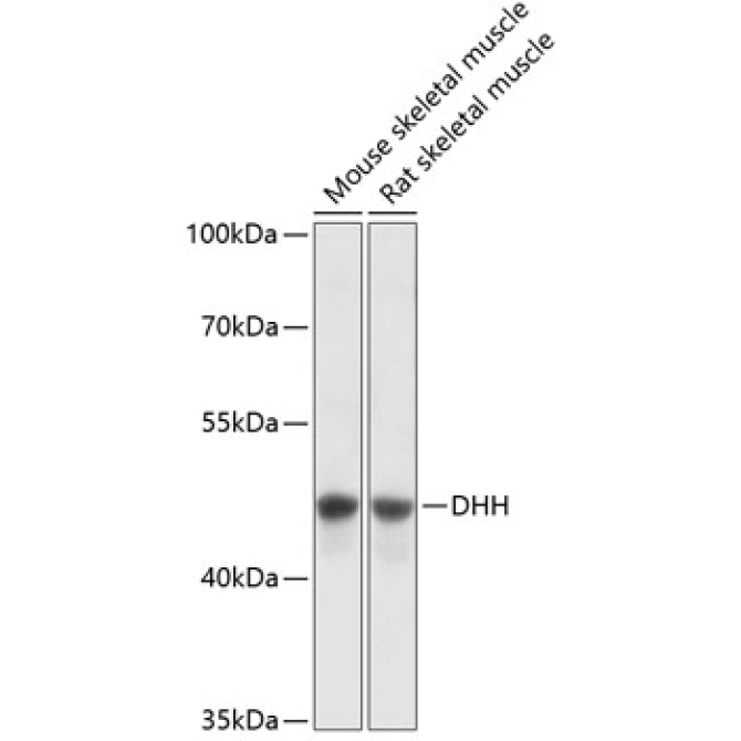 DHH Rabbit Polyclonal Antibody