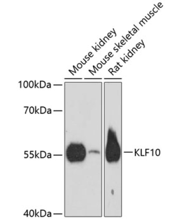 KLF10 Rabbit Polyclonal Antibody
