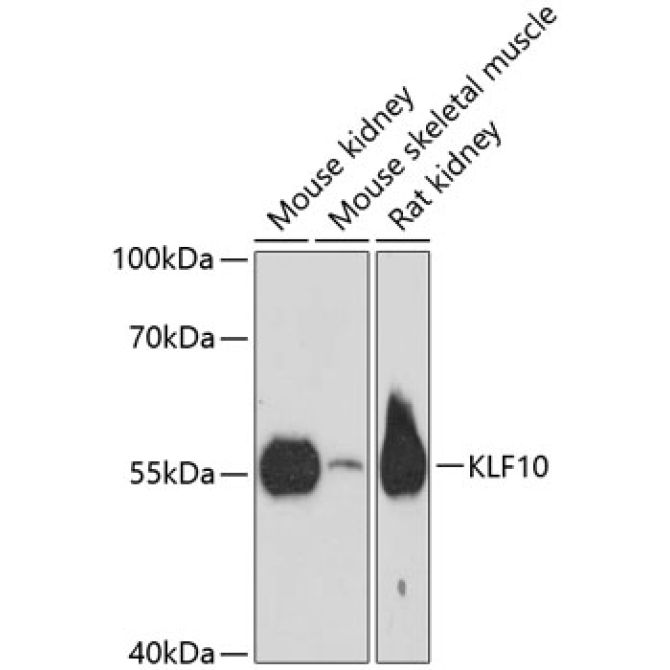 KLF10 Rabbit Polyclonal Antibody