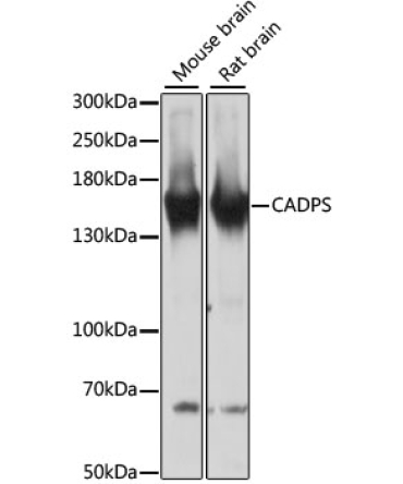 CADPS Rabbit Polyclonal Antibody