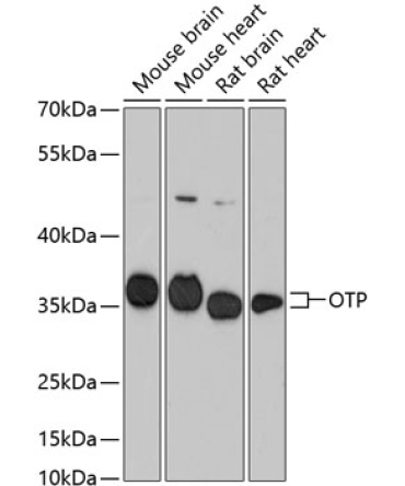OTP Rabbit Polyclonal Antibody