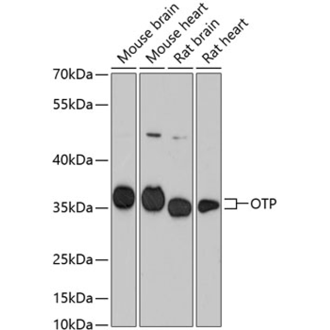 OTP Rabbit Polyclonal Antibody