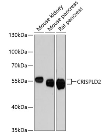 CRISPLD2 Rabbit Polyclonal Antibody
