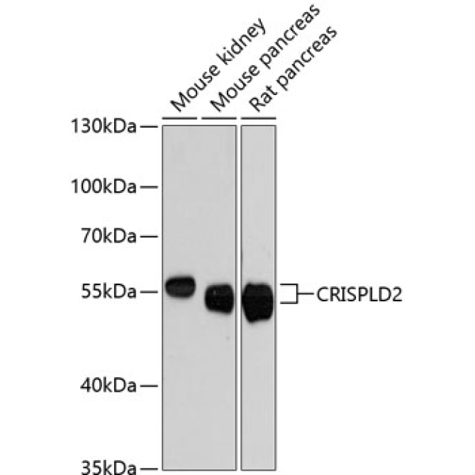 CRISPLD2 Rabbit Polyclonal Antibody