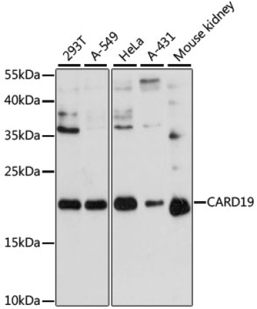 CARD19 Rabbit Polyclonal Antibody