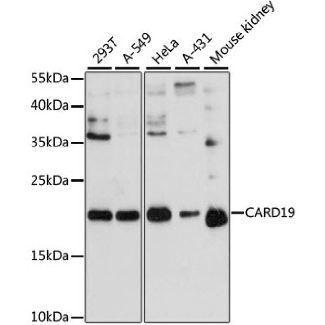 CARD19 Rabbit Polyclonal Antibody