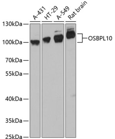 OSBPL10 Rabbit Polyclonal Antibody