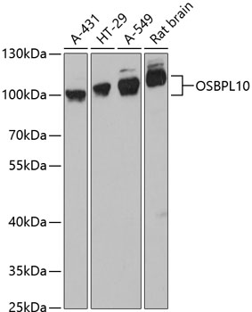 OSBPL10 Rabbit Polyclonal Antibody