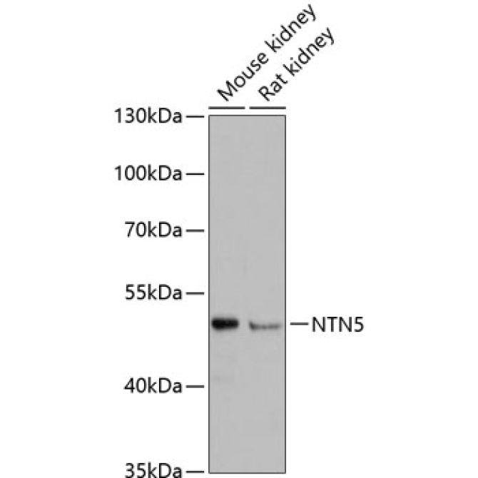 NTN5 Rabbit Polyclonal Antibody
