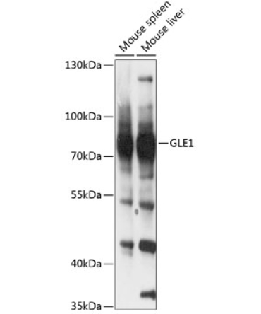GLE1 Rabbit Polyclonal Antibody