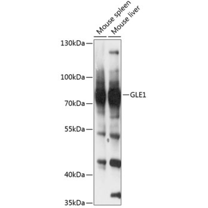 GLE1 Rabbit Polyclonal Antibody