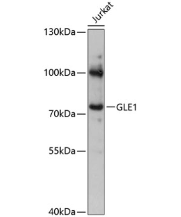 GLE1 Rabbit Polyclonal Antibody