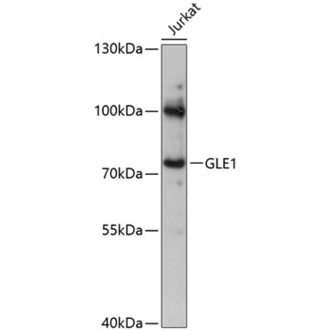 GLE1 Rabbit Polyclonal Antibody