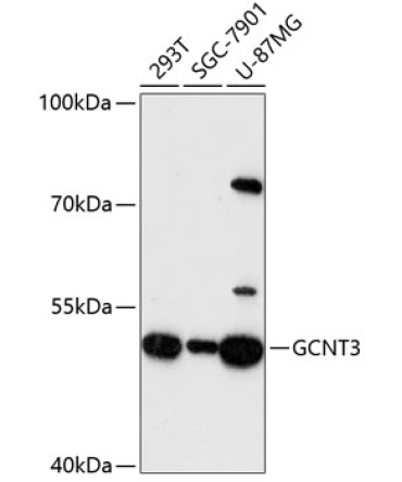 GCNT3 Rabbit Polyclonal Antibody