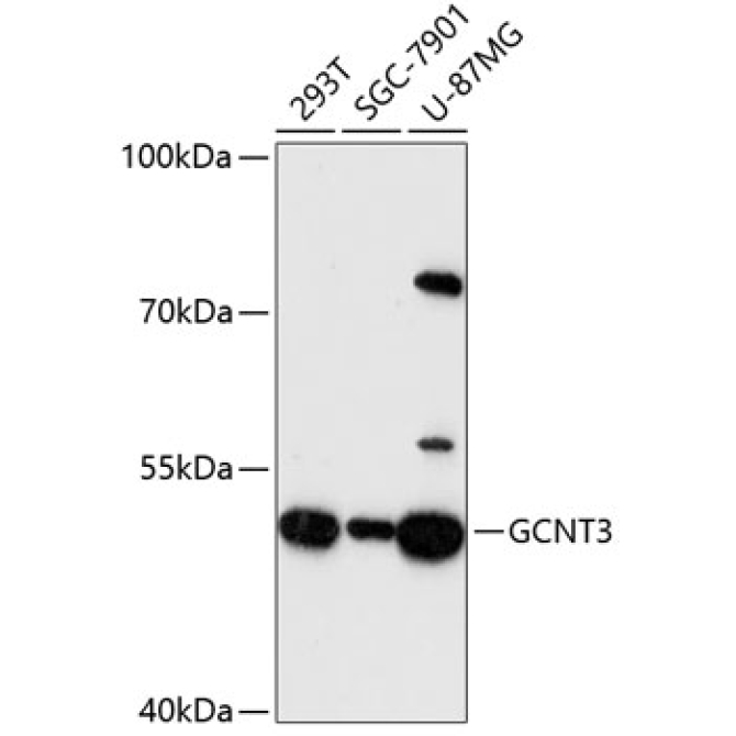 GCNT3 Rabbit Polyclonal Antibody