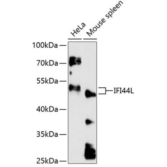 IFI44L Rabbit Polyclonal Antibody