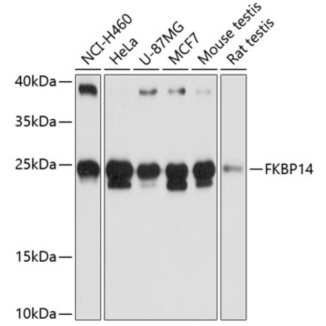 FKBP14 Rabbit Polyclonal Antibody