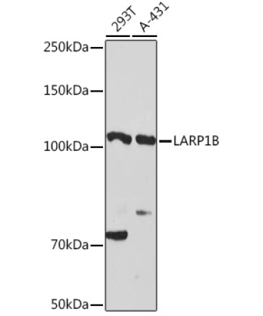 LARP1B Rabbit Polyclonal Antibody