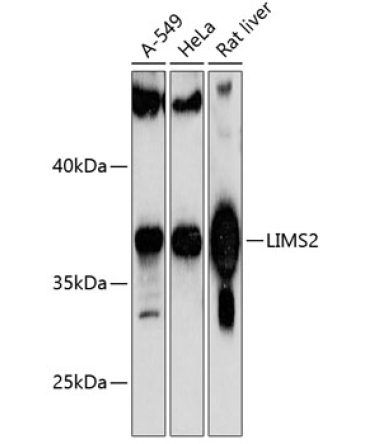 LIMS2 Rabbit Polyclonal Antibody