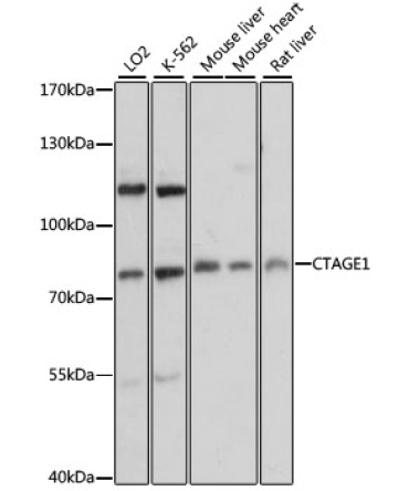 CTAGE1 Rabbit Polyclonal Antibody