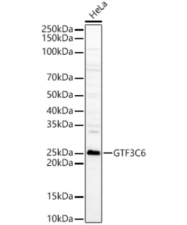 GTF3C6 Rabbit Polyclonal Antibody
