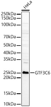 GTF3C6 Rabbit Polyclonal Antibody