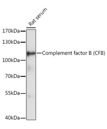 Complement factor B (CFB) Rabbit Polyclonal Antibody
