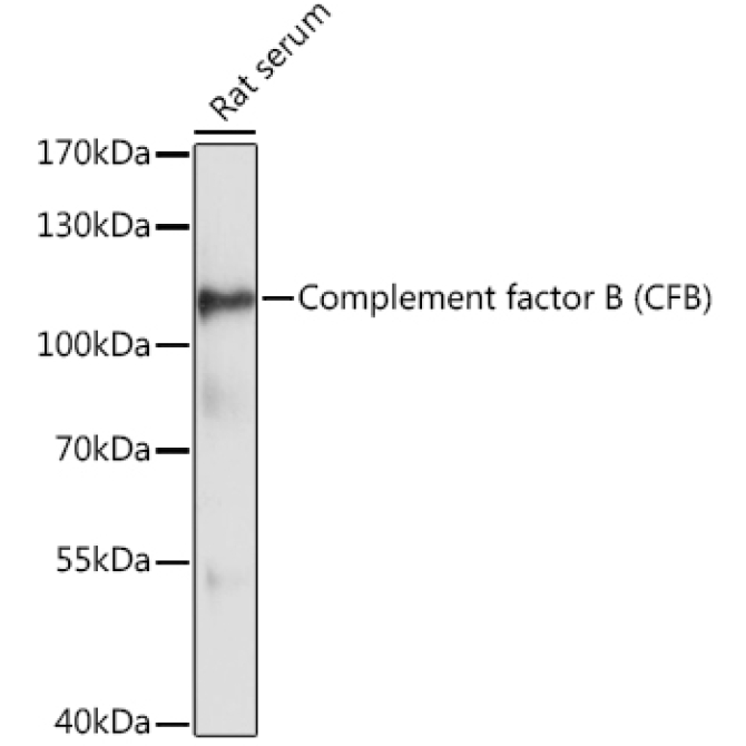 Complement factor B (CFB) Rabbit Polyclonal Antibody