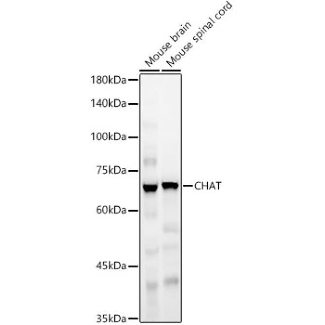 CHAT Rabbit Polyclonal Antibody
