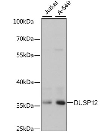 DUSP12 Rabbit Polyclonal Antibody