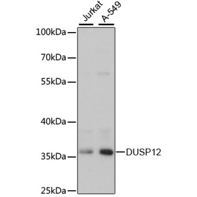 DUSP12 Rabbit Polyclonal Antibody