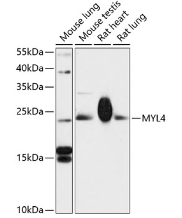 MYL4 Rabbit Polyclonal Antibody