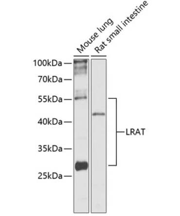 LRAT Rabbit Polyclonal Antibody