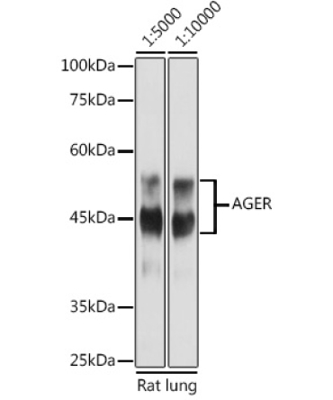 AGER Rabbit Polyclonal Antibody