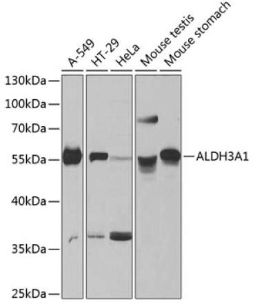 ALDH3A1 Rabbit Polyclonal Antibody