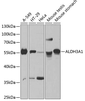 ALDH3A1 Rabbit Polyclonal Antibody
