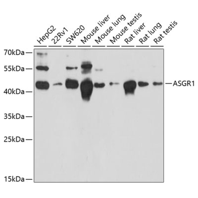 ASGR1 Rabbit Polyclonal Antibody