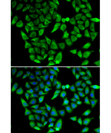 ASIP Rabbit Polyclonal Antibody