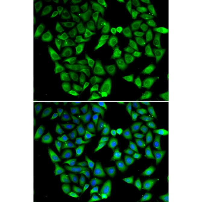 ASIP Rabbit Polyclonal Antibody