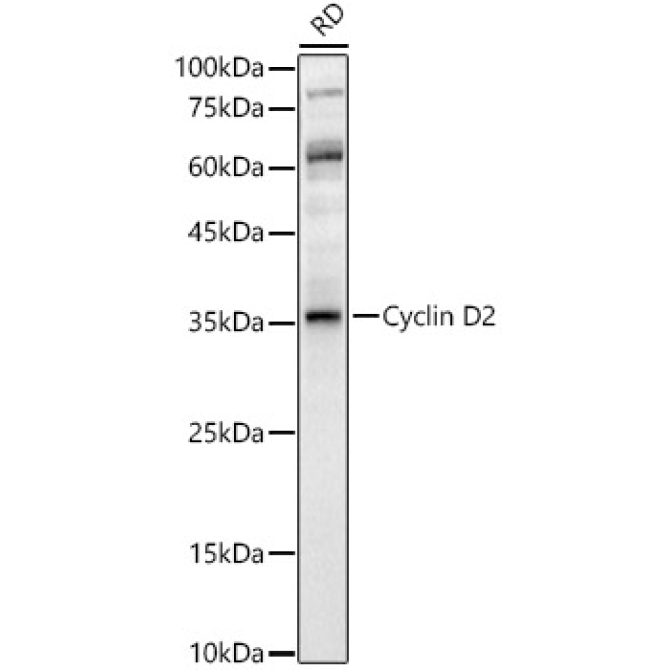 Cyclin D2 Rabbit Polyclonal Antibody