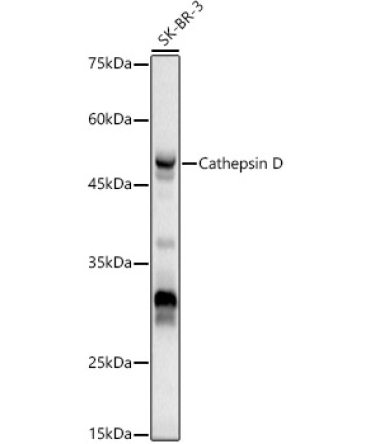 Cathepsin D Rabbit Polyclonal Antibody