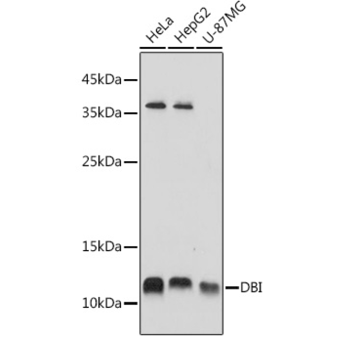 DBI Rabbit Polyclonal Antibody
