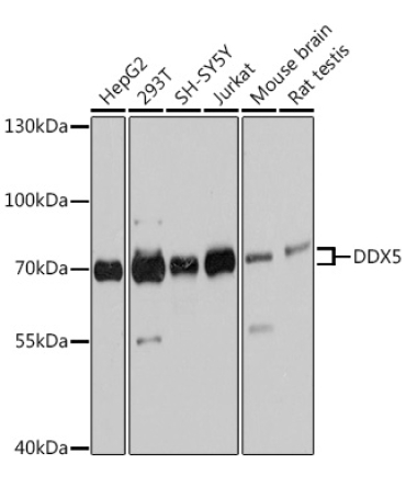 DDX5 Rabbit Polyclonal Antibody