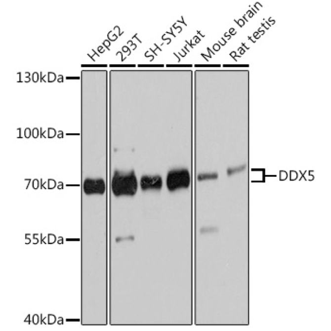 DDX5 Rabbit Polyclonal Antibody