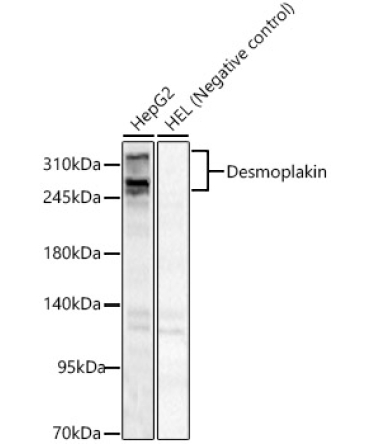 Desmoplakin Rabbit Polyclonal Antibody