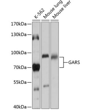 GARS Rabbit Polyclonal Antibody