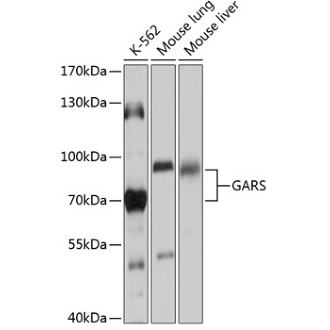 GARS Rabbit Polyclonal Antibody